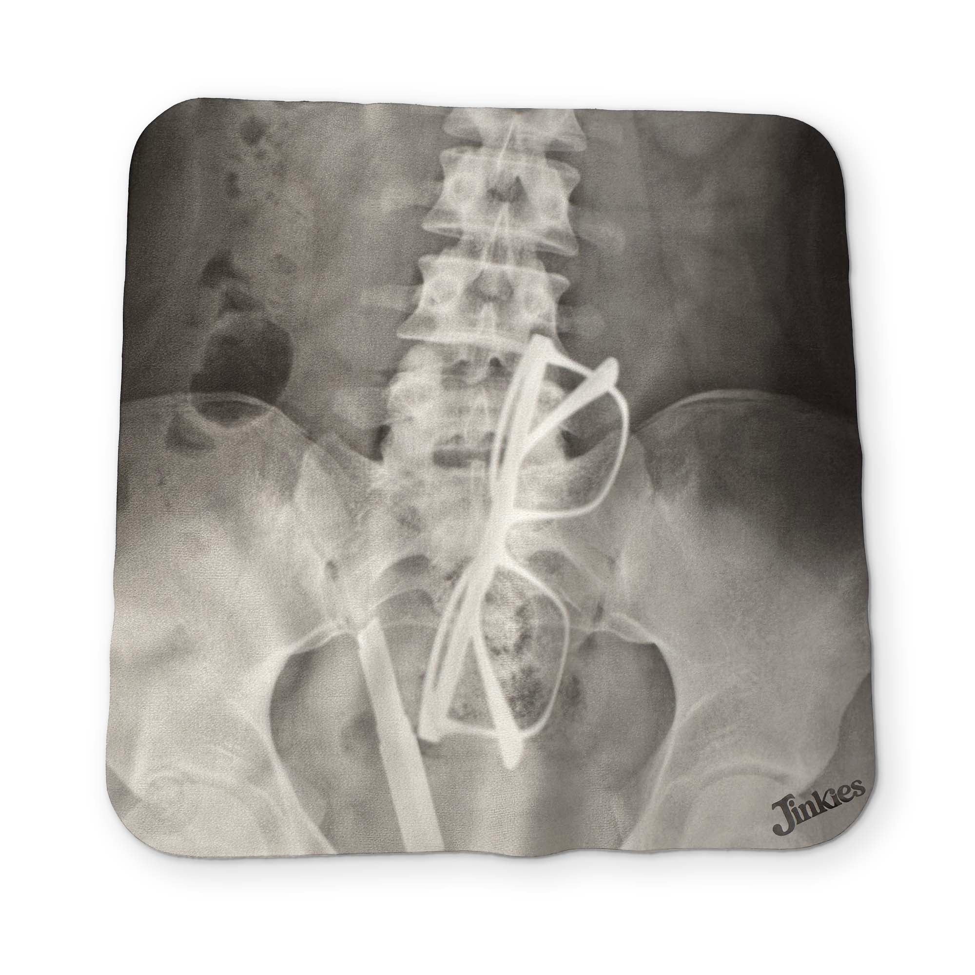 AN  X-RAY YOU CAN CLEAN YOUR GLASSES WITH - Image 2